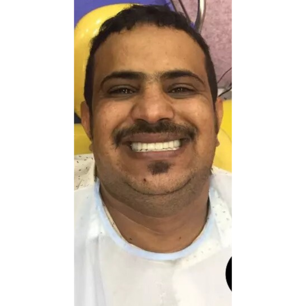 The Dental Lounge patient after the treatment